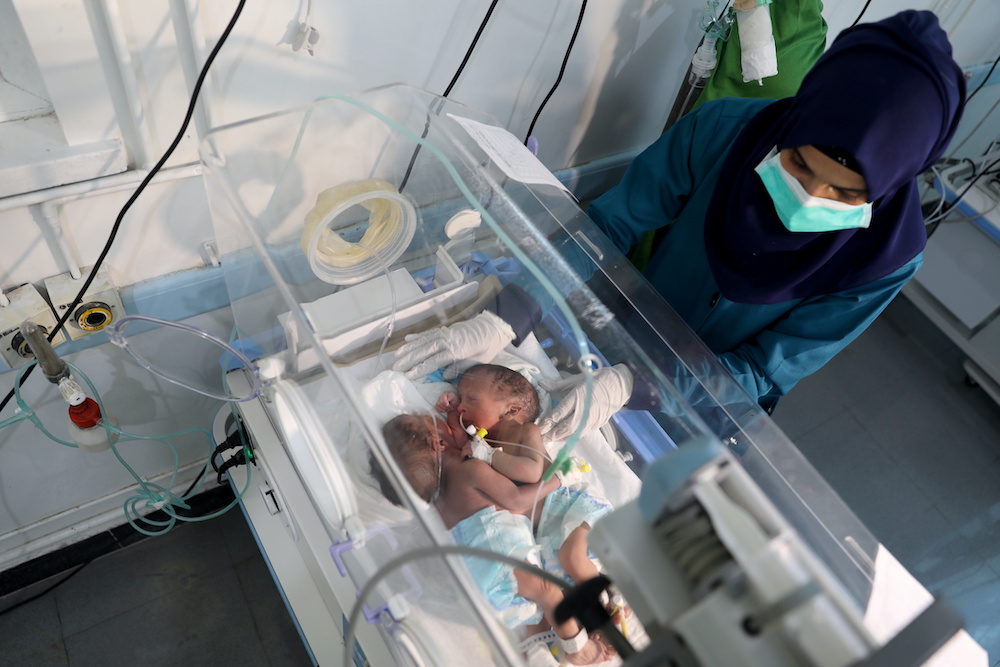 A nurse attends to newly born conjoined twins in an incubator at the child intensive care unit of Al-Sabeen hospital in Sanaa, Yemen Dec. 18, 2020. (Reuters) A nurse attends to newly born conjoined twins in an incubator at the child intensive care unit of Al-Sabeen hospital in Sanaa, Yemen Dec. 18, 2020. (Reuters)